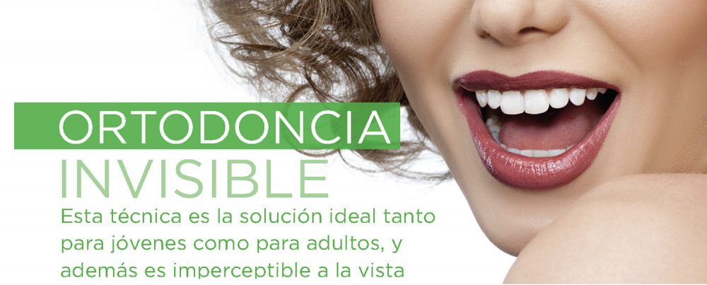 Clinica Smilodon - Ortodoncia Invisible