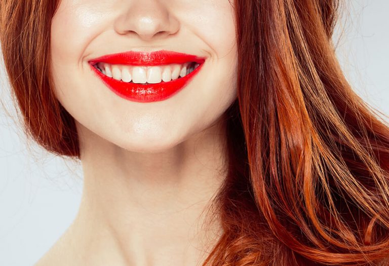 Preguntas y respuestas sobre blanqueamiento dental