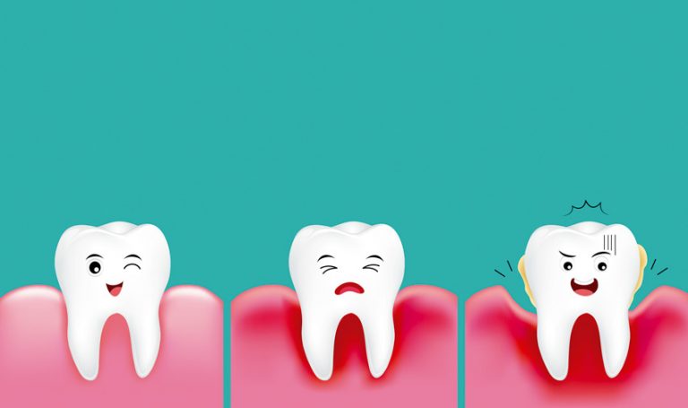 Enfermedad periodontal y su relación con otras patologías. Clínica Smilodon