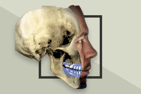 cbct-3d smilodon