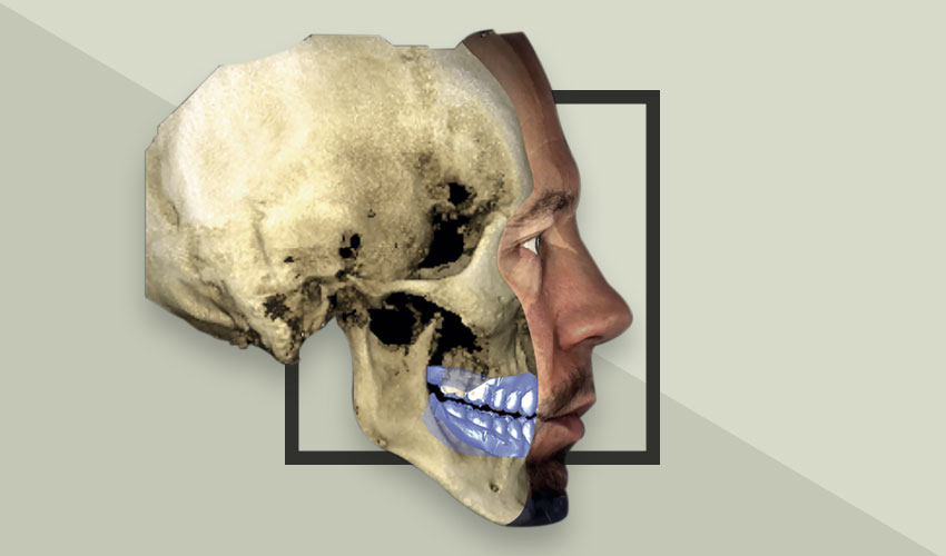 cbct-3d smilodon