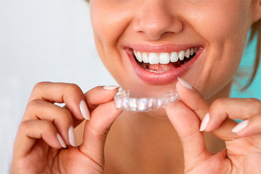 invisalign-alineador