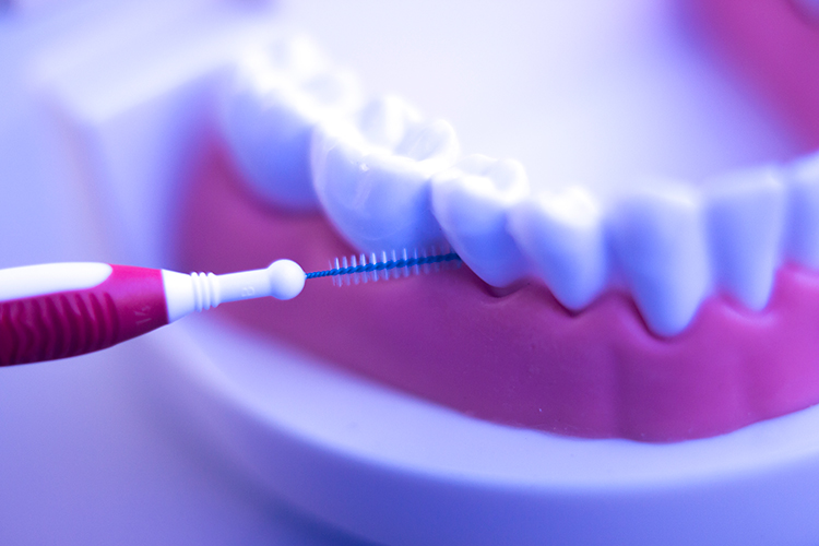 cepillo-interproximal
