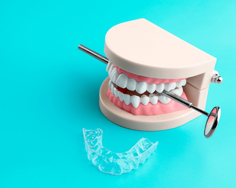 Desgaste dental. Clínica Smilodon