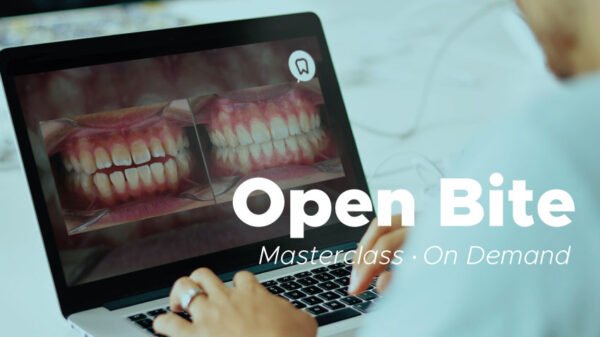 Open-bite-ondemand