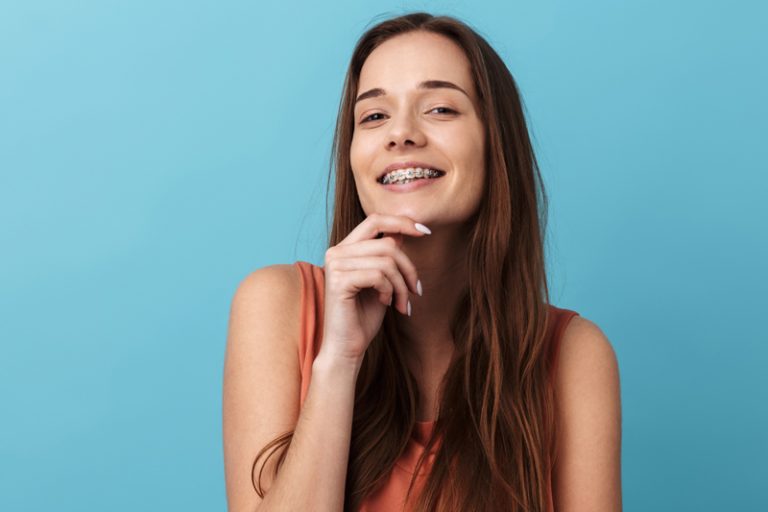 5 consejos si te acabas de poner Brackets