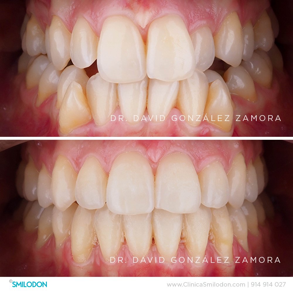 Ortodoncia - Clínica Dental Molina