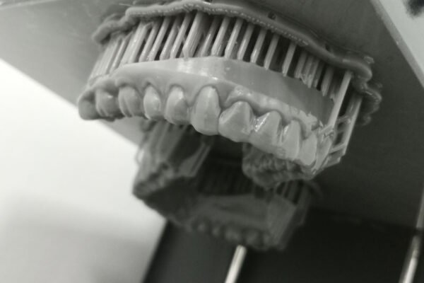 Impresión 3D en Odontología