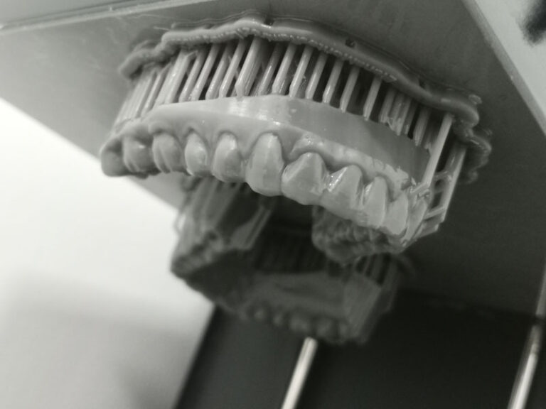 Impresión 3D en Odontología