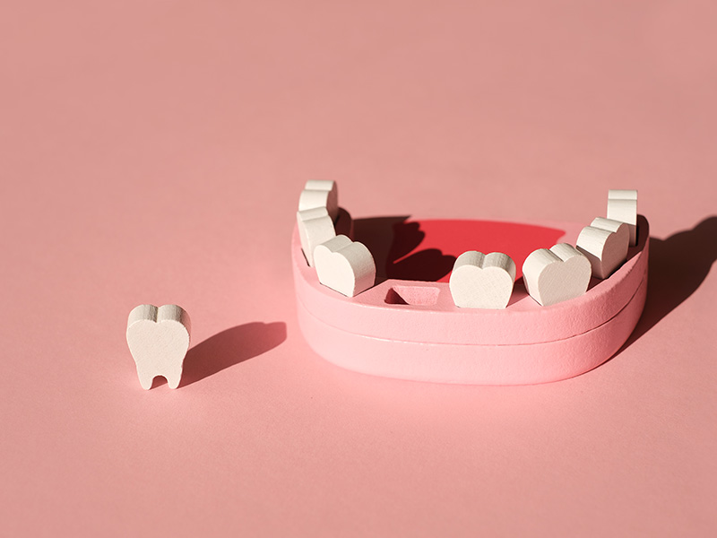 avulsion-dental