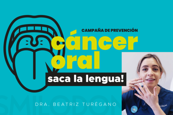 Autoexploración cáncer oral