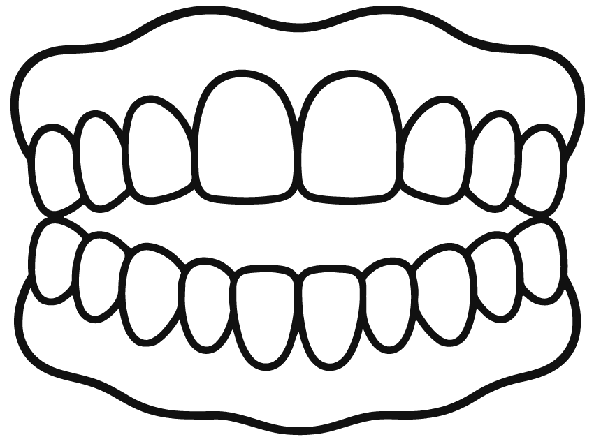Mordida-abierta