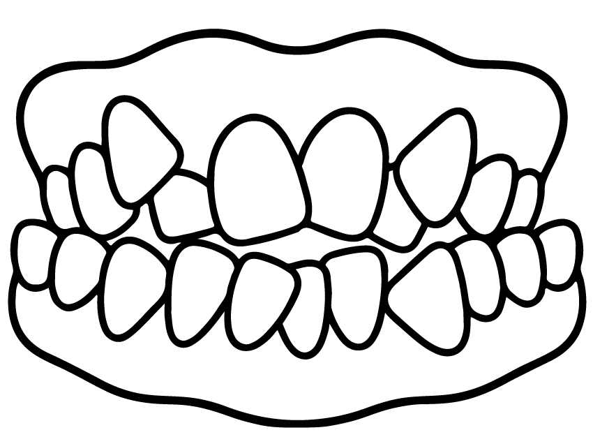 apiñamiento