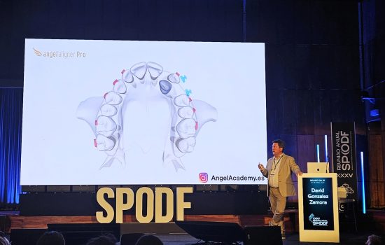 ortodoncia invisible spodf